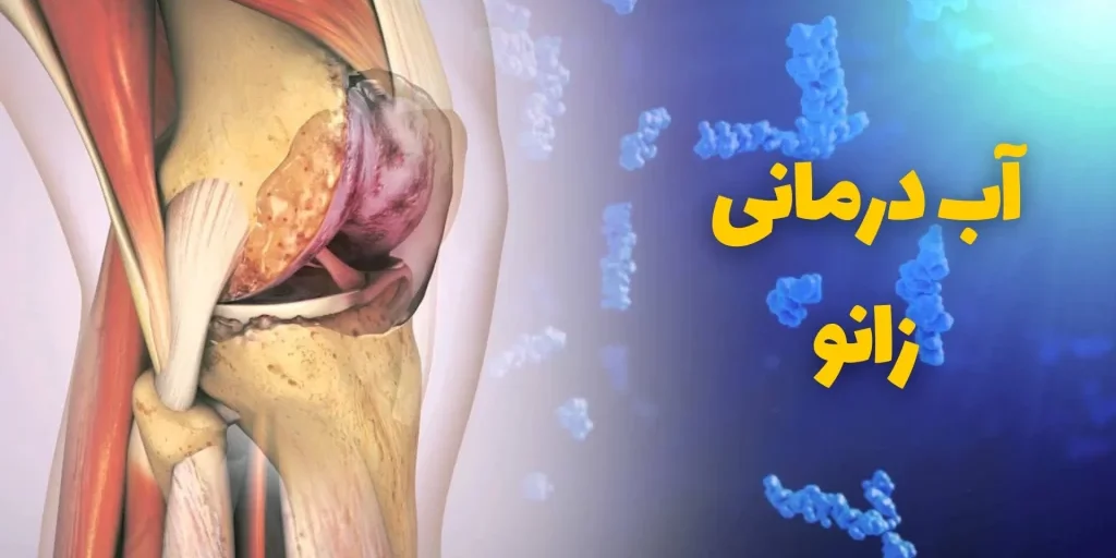 آب درمانی زانو